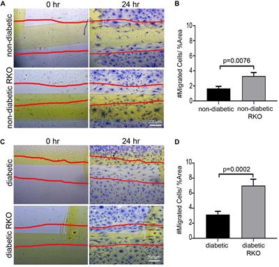 The Impact of Diabetic Conditions and AGE/RAGE Signaling on Cardiac <mark class="highlighted">Fibroblast Migration</mark>
